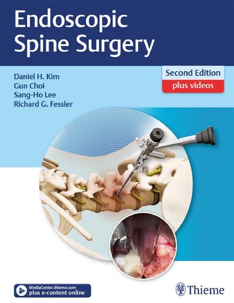 Produktbild: Endoscopic Spine Surgery