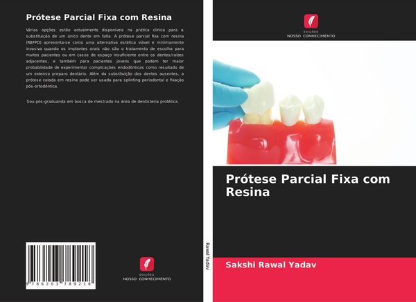Produktbild: Pr&oacute;tese Parcial Fixa com Resina