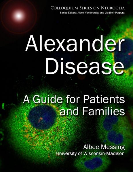 Produktbild: Alexander Disease