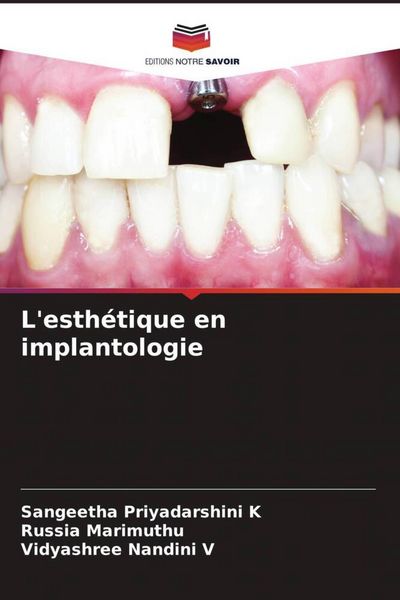 Produktbild: L'esth&eacute;tique en implantologie