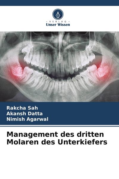Produktbild: Management des dritten Molaren des Unterkiefers