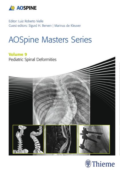 Produktbild: AOSpine Masters Series, Volume 9: Pediatric Spinal Deformities