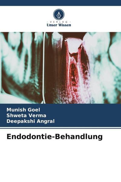 Endodontie-Behandlung, Taschenbuch von Munish Goel , Shweta Verma , Deepakshi Angral, Verlag Unser Wissen, 9786205965726
