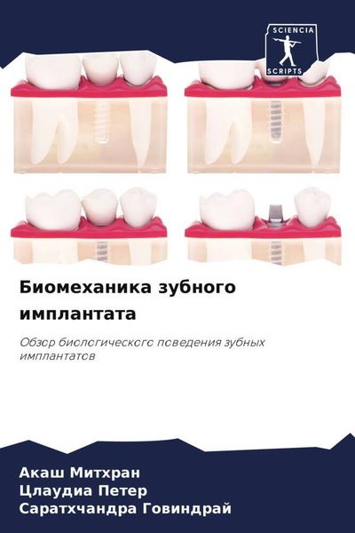 Produktbild: Biomehanika zubnogo implantata