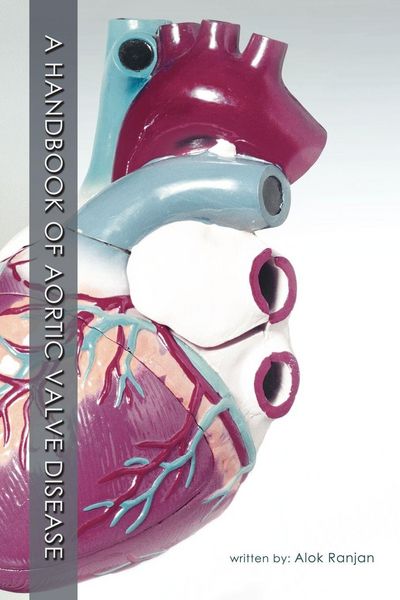 Produktbild: A Handbook Of Aortic Valve Disease