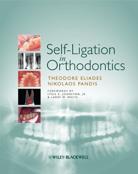 Produktbild: Self-Ligation in Orthodontics