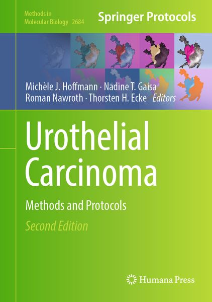Produktbild: Urothelial Carcinoma