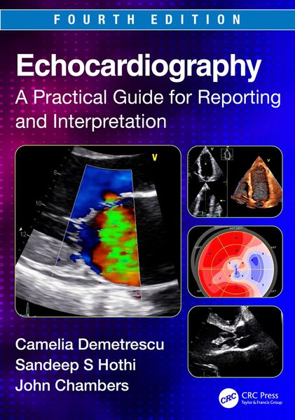 Produktbild: Echocardiography