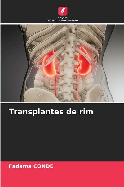 Produktbild: Transplantes de rim