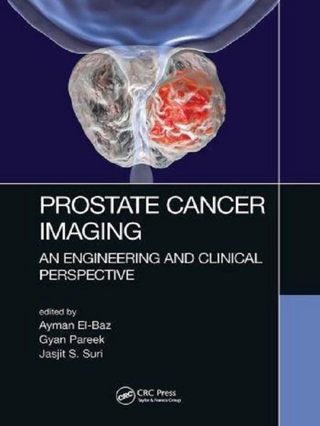 Produktbild: Prostate Cancer Imaging