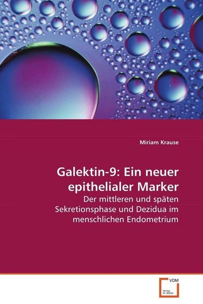 Krause Miriam: Galektin-9: Ein neuer epithelialer Marker, Taschenbuch von Miriam Krause, VDM, 9783639056716