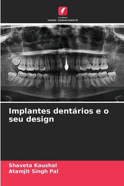 Produktbild: Implantes dent&aacute;rios e o seu design