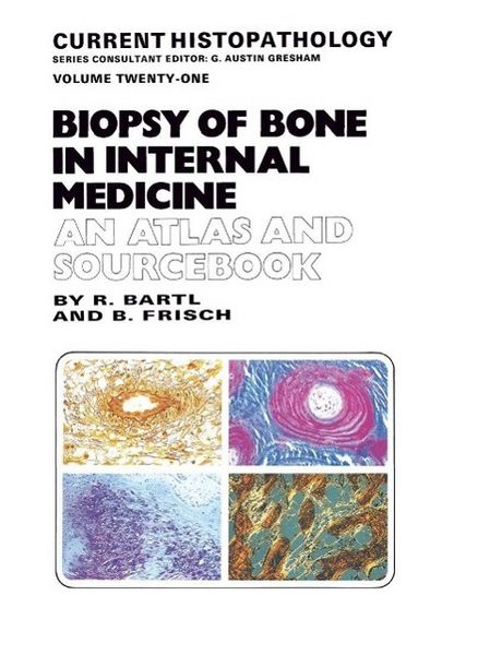 Produktbild: Biopsy of Bone in Internal Medicine: An Atlas and Sourcebook