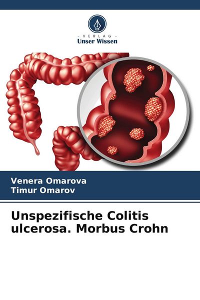 Unspezifische Colitis ulcerosa. Morbus Crohn, Taschenbuch von Venera Omarova , Timur Omarov, Verlag Unser Wissen, 9786205431160