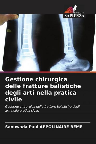 Produktbild: Gestione chirurgica delle fratture balistiche degli arti nella pratica civile