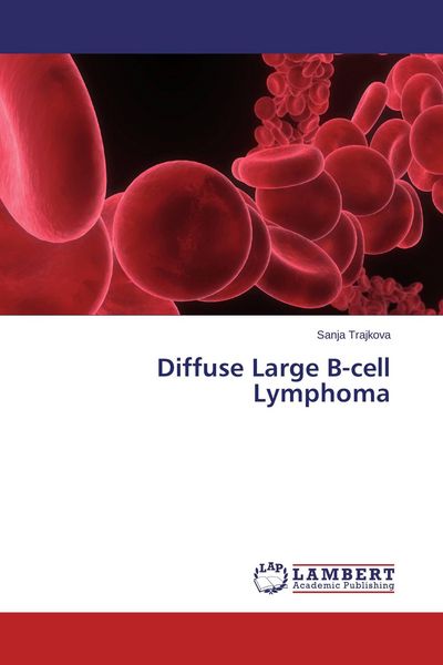 Produktbild: Diffuse Large B-cell Lymphoma