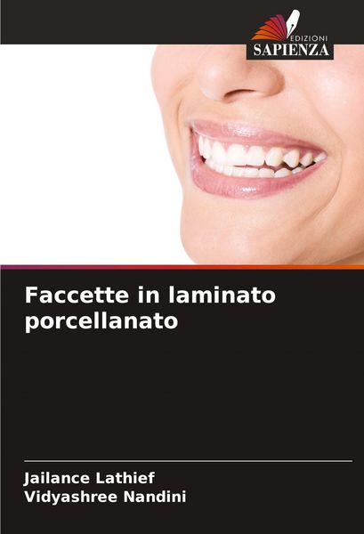 Produktbild: Faccette in laminato porcellanato