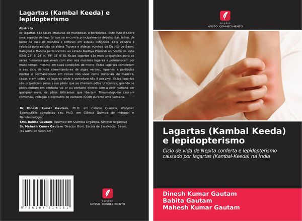 Produktbild: Lagartas (Kambal Keeda) e lepidopterismo