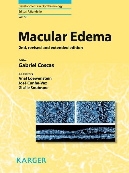 Produktbild: Macular Edema