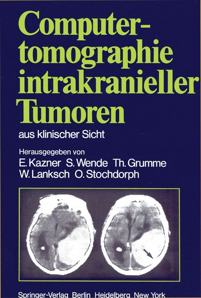 Produktbild: Computertomographie intrakranieller Tumoren aus klinischer Sicht