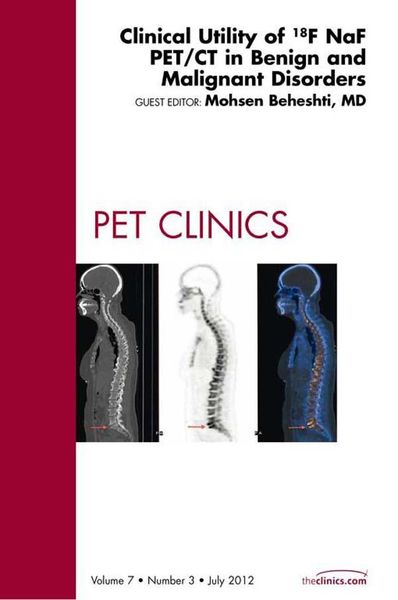 Produktbild: Clinical Utility of 18NaF PET/CT in Benign and Malignant Disorders, An Issue of PET Clinics