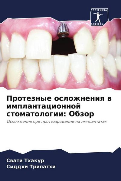 Produktbild: Proteznye oslozhneniq w implantacionnoj stomatologii: Obzor
