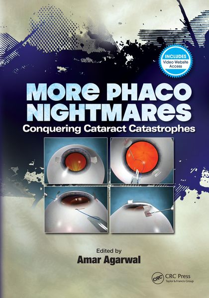 Produktbild: More Phaco Nightmares