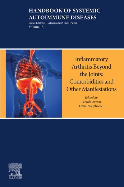 Produktbild: Inflammatory Arthritis Beyond the Joints
