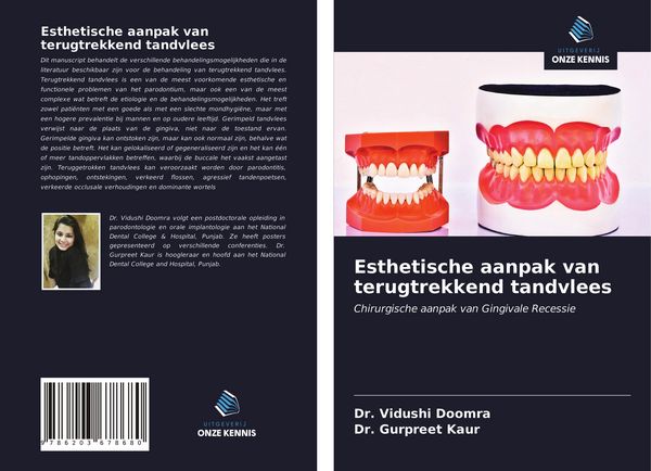 Produktbild: Esthetische aanpak van terugtrekkend tandvlees