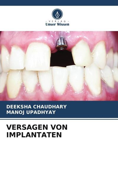 Produktbild: Versagen von Implantaten