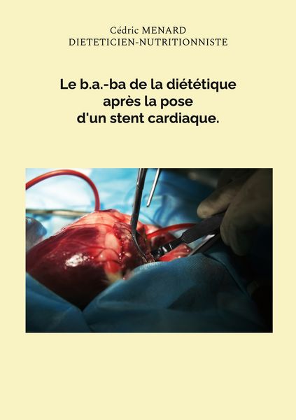 Produktbild: Le b.a.-ba de la di&eacute;t&eacute;tique apr&egrave;s la pose d'un stent cardiaque.