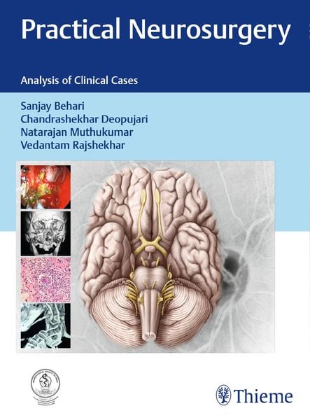 Produktbild: Practical Neurosurgery