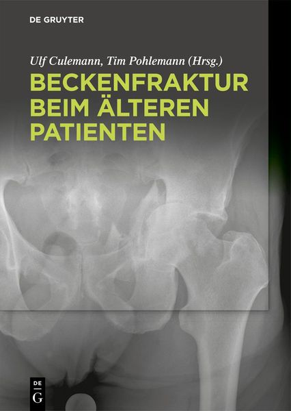 Produktbild: Beckenfraktur beim &auml;lteren Patienten
