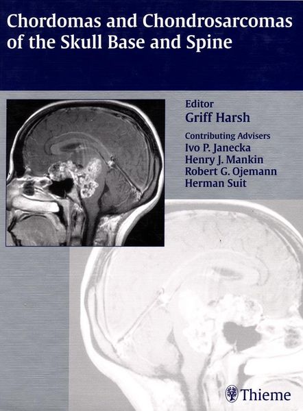 Produktbild: Chordomas and Chondrosarcomas of the Skull Base and Spine