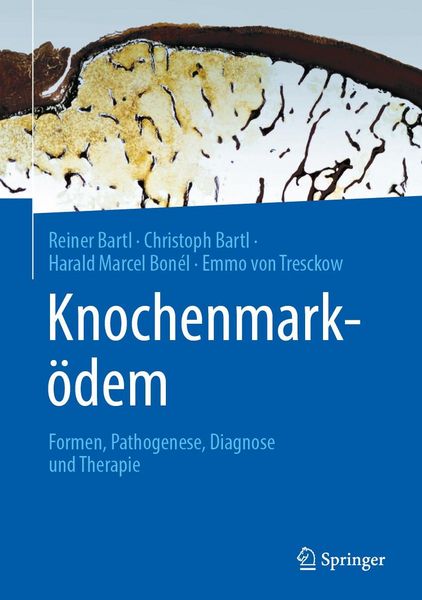 Produktbild: Knochenmark&ouml;dem