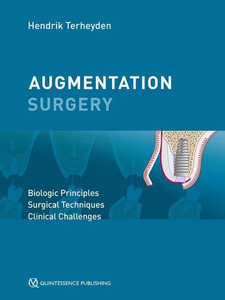 Produktbild: Augmentation Surgery