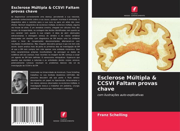 Produktbild: Esclerose M&uacute;ltipla & CCSVI Faltam provas chave