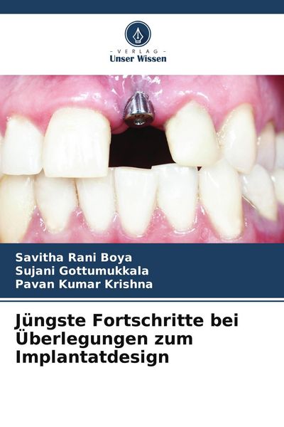 Jüngste Fortschritte bei Überlegungen zum Implantatdesign, Taschenbuch von Savitha Rani Boya , Sujani Gottumukkala , Pavan Kumar Krishna, Verlag Unser