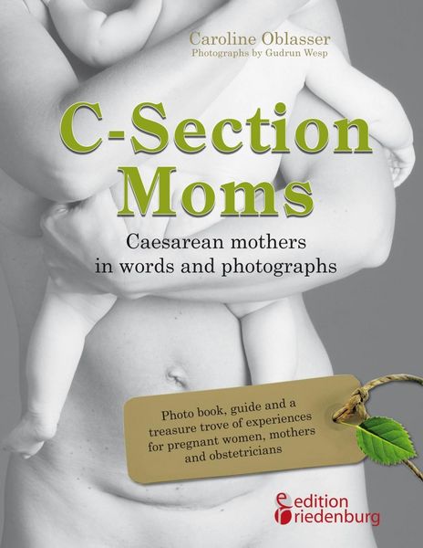 Produktbild: C-Section Moms - Caesarean mothers in words and photographs