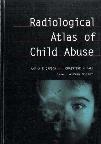 Produktbild: Offiah, A: Radiological Atlas of Child Abuse