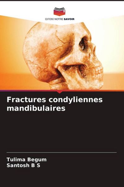 Produktbild: Fractures condyliennes mandibulaires