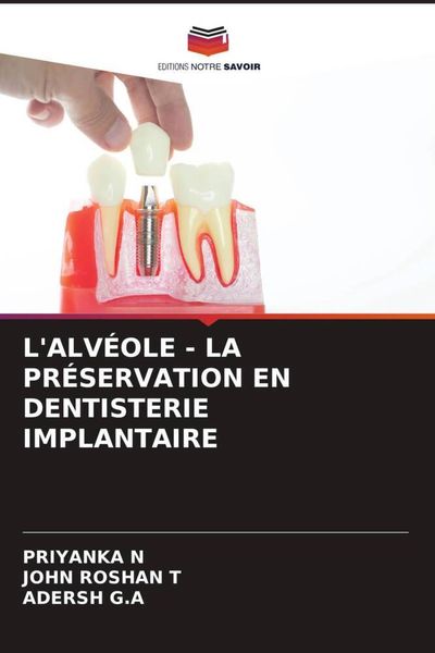 Produktbild: L'alv&eacute;ole - La Pr&eacute;servation En Dentisterie Implantaire