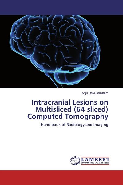 Produktbild: Intracranial Lesions on Multisliced (64 sliced) Computed Tomography