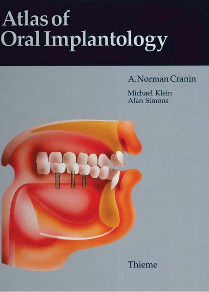 Produktbild: Atlas of Oral Implantology