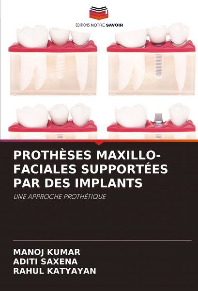 Produktbild: Proth&egrave;ses Maxillo-Faciales Support&eacute;es Par des Implants