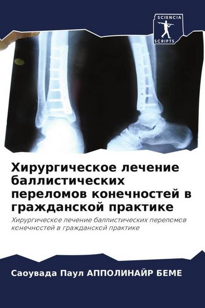Produktbild: Hirurgicheskoe lechenie ballisticheskih perelomow konechnostej w grazhdanskoj praktike
