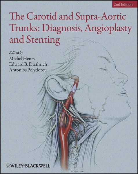 Produktbild: The Carotid and Supra-Aortic Trunks