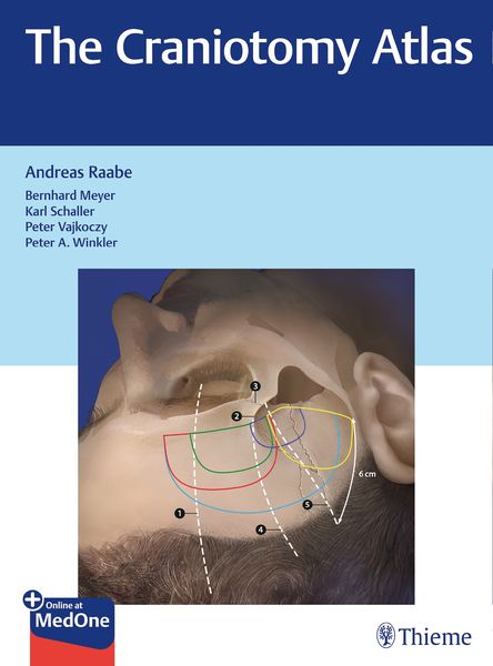 Produktbild: The Craniotomy Atlas