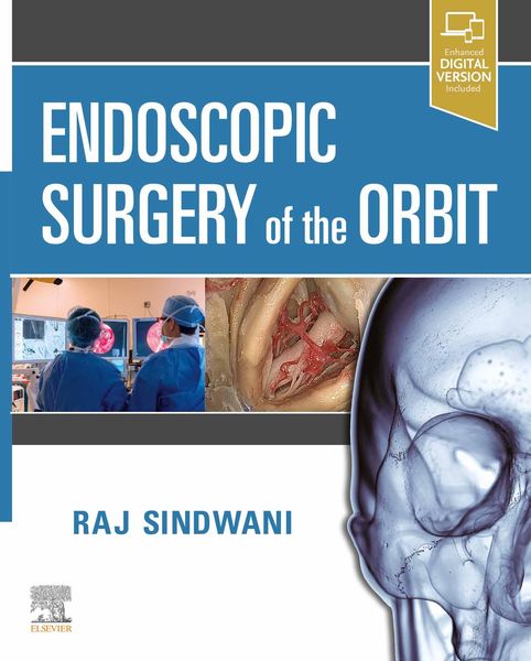Produktbild: Endoscopic Surgery of the ORBIT E-Book