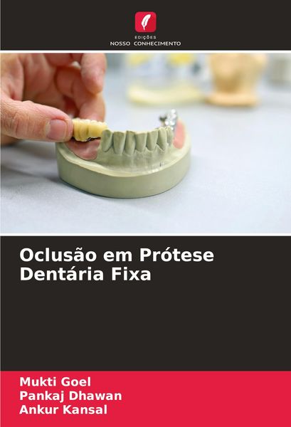 Produktbild: Oclus&atilde;o em Pr&oacute;tese Dent&aacute;ria Fixa